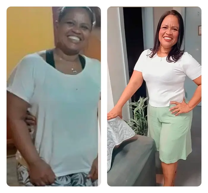 ANTES_DEPOIS1